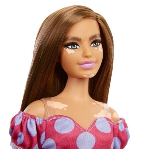 Barbie Fashionista 171 – Vitiligo Skin & Polka Dot Dress - Image 2